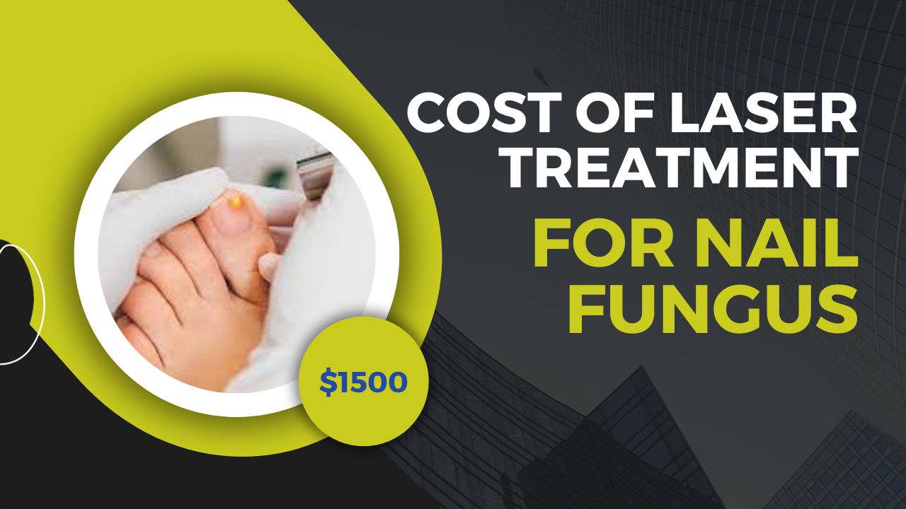 Price for fungus treatment