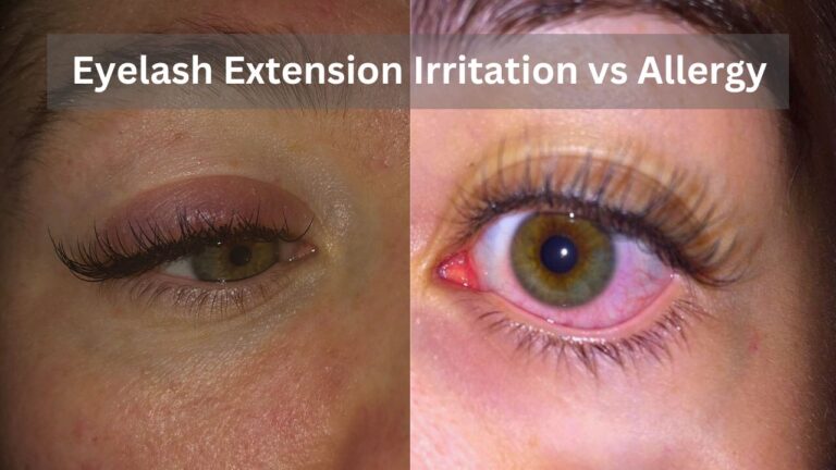 A Complete Guide About Eyelash Extension Irritation vs Allergy